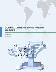 Global Lumbar Spine Fusion Market 2016-2020