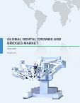 Global Dental Crowns and Bridges Market 2016-2020