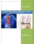 Global Spinal Cord Stimulation Market: Trends & Opportunities (2014-19)