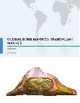 Global Bone Marrow Transplant Market 2017-2021