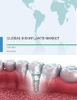 Global Bioimplants Market 2017-2021