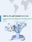 Dental Implants Market in China 2016-2020